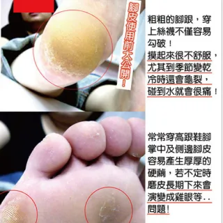 【日本Beauty Foot】去角質足膜-大尺寸(30mlx2枚入)
