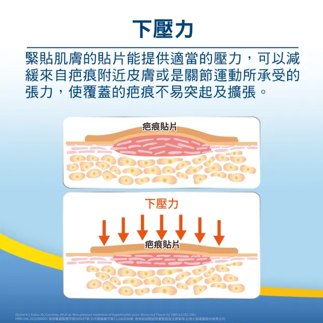 【HiruDerm 喜能膚】疤痕貼片7cmX10cm 1盒(5片/盒)