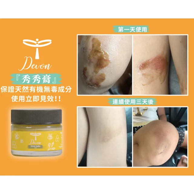 【DeVoN 德氛】秀秀蜂膠膏 15ml(天然無人工添加 蠶豆症可使用)