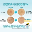 【derma　Angel 護妍天使】淨瑕修護貼好評96貼(24貼x4盒)