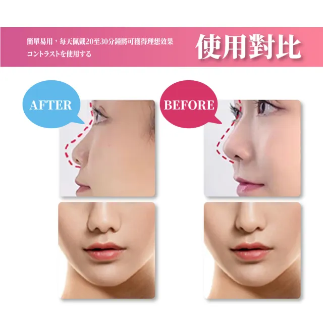 【物理美鼻】日本3D鼻樑美鼻夾(挺鼻夾 增高器 鼻翼 夾鼻器 高鼻樑 翹鼻器 美容 鼻樑按摩 修容鼻影)