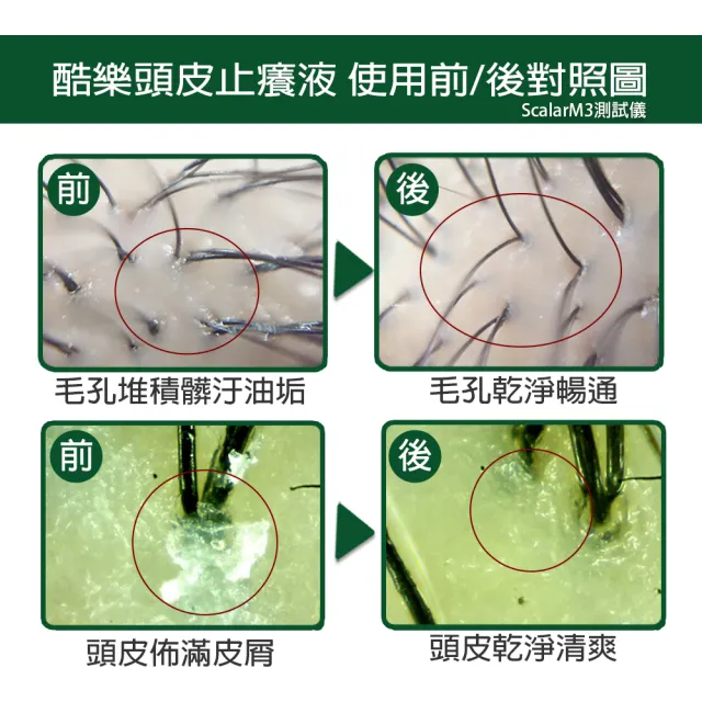 【arin氧潤】酷樂頭皮止癢液120ml(頭皮水/頭皮精華/頭皮去角質)