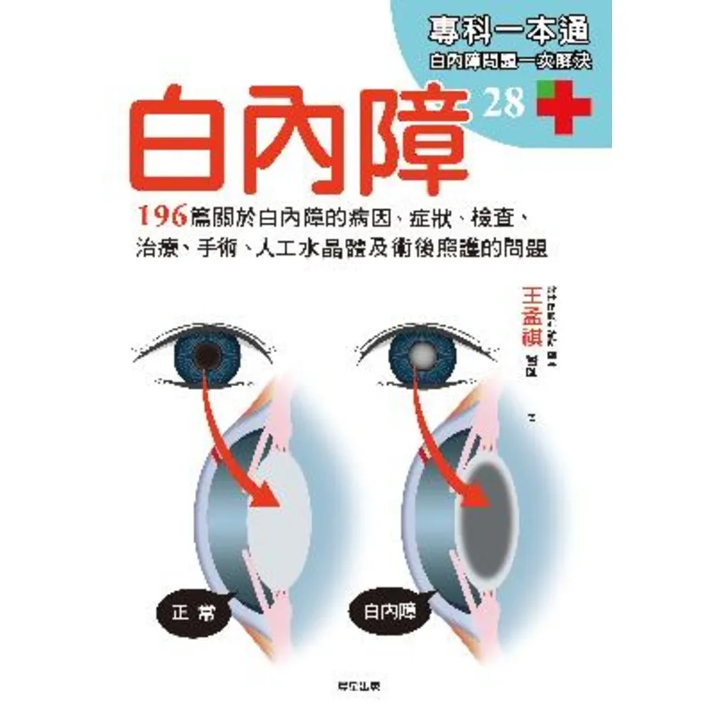 【momoBOOK】白內障：196篇關於白內障的病因、症狀、檢查、治療、手術、人工水晶體以及術後照(電子書)