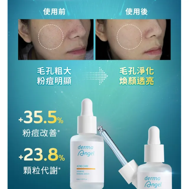 【derma Angel 護妍天使】三重酸極效煥膚精華(30ml)