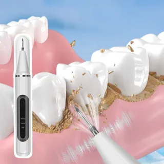 【深層潔淨】防水智能帶燈沖牙機(LED 潔牙器 震動 電動牙刷 牙齒 洗牙器 去牙垢 牙結石 沖牙器 亮白)