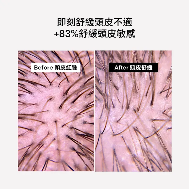 【L’OREAL 巴黎萊雅PRO】絲漾博瞬效敏弱修護洗髮精300ml