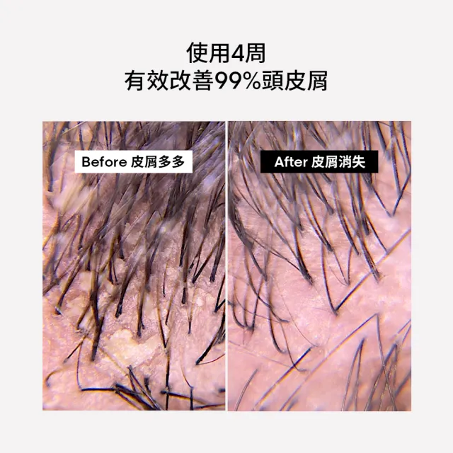 【L’OREAL 巴黎萊雅PRO】絲漾博長效去屑洗髮精500ml(去屑/抗屑)