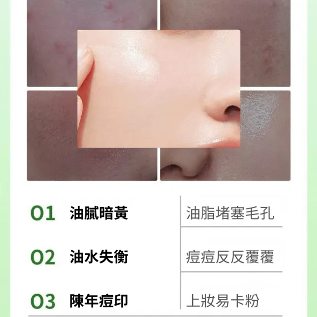 【iBloom】洛婭水楊酸果酸次拋精華液 1.5ml/支*30支(痘痘 痘印 痘坑 水楊酸 清爽控油)