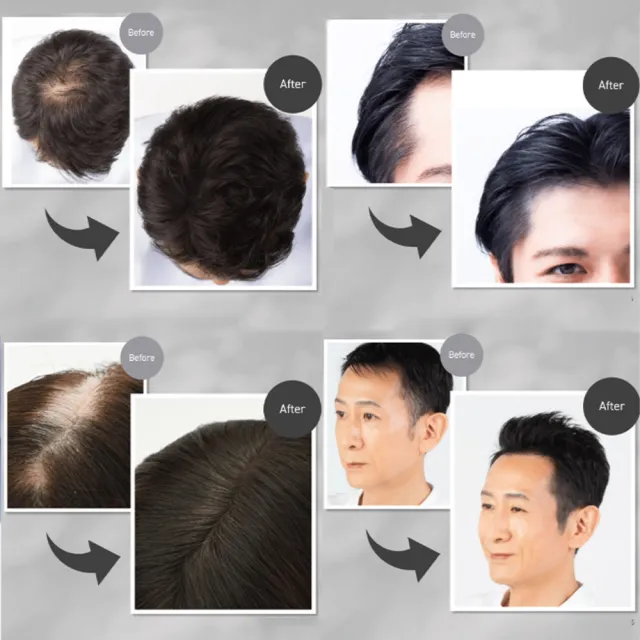 【Super Million Hair總代理】SMH絲密赫 男性髮粉底20g_黑(靜電原理/防水/防汗)