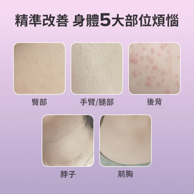 【Paulas Choice 寶拉珍選】2%水楊酸身體乳210ml(煥膚/抗痘/粉刺/去角質)