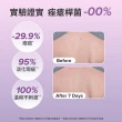 【寶拉珍選】2%水楊酸身體乳210ml(煥膚/抗痘/粉刺/去角質)
