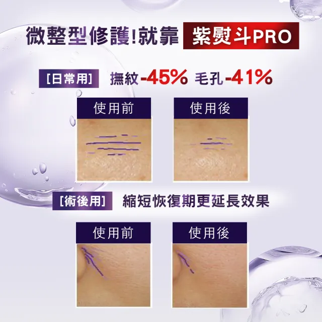 【LOREAL Paris 巴黎萊雅】玻尿酸眼霜級撫紋精華霜30ml_2入組(紫熨斗版x2/雙熨斗版-紫熨斗+冰熨斗)