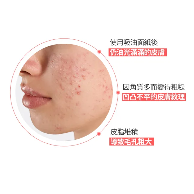 即期品【AESTURA 璦絲特蘭】每日清痘倍護淨透水分煥活保濕霜 60ml(保濕/抗痘/痘痘調理/水楊酸)