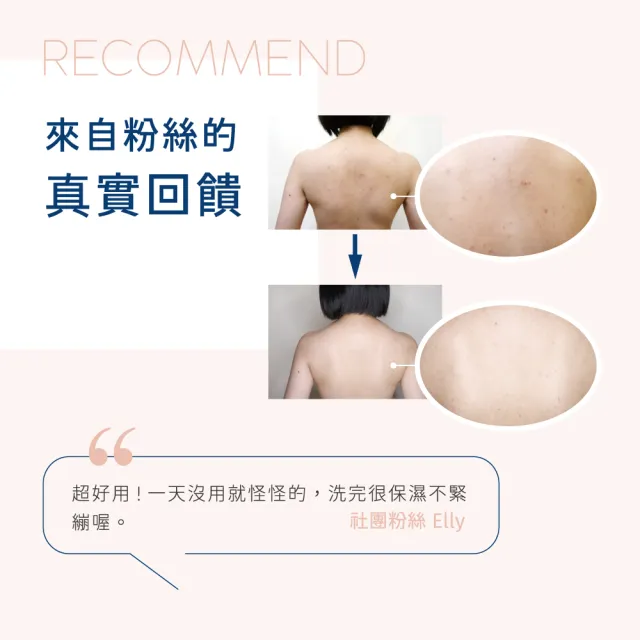 【INGENI 新肌霓】美背計畫-淨痘平衡沐浴露500ml(臉部保養等級研發 輕鬆擺脫身體痘)