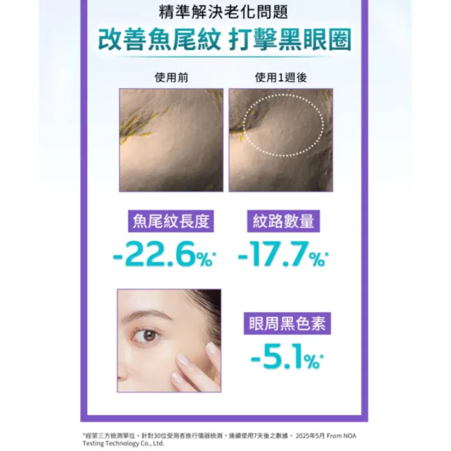【derma Angel 護妍天使】0.3%緊緻撫紋A醇亮眼霜(15ml)