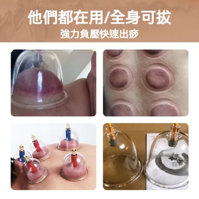 【華佗牌】華佗牌12罐拔罐組錦緞禮盒裝(禮盒 送禮 拔罐杯 拔罐器 手動真空拔罐)