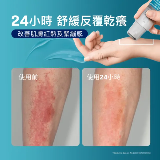 【Cetaphil 舒特膚】官方直營 AD益膚康瞬效舒敏凝膠59ml(新品上市/隨身小冰塊)