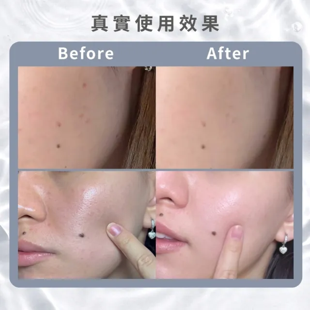 【韓國美膚】Rejuveon PDRN 修復面霜-20g