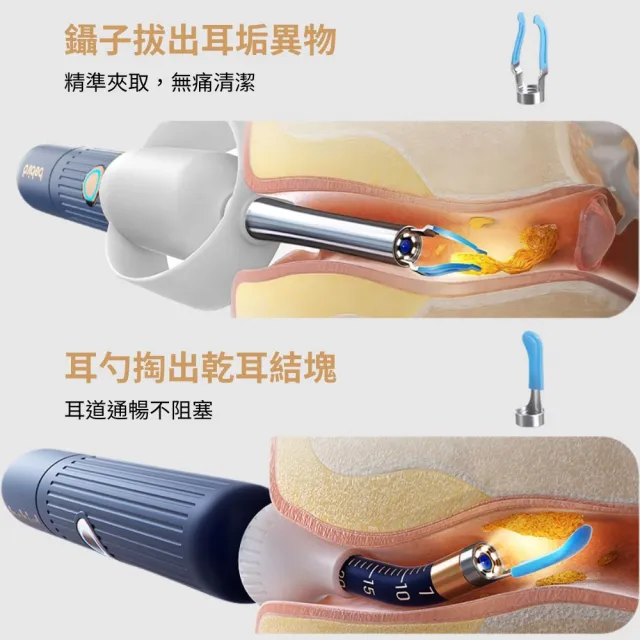 【BEBIRD】蜂鳥 3 EARCARE 智能可視掏耳棒-i35R