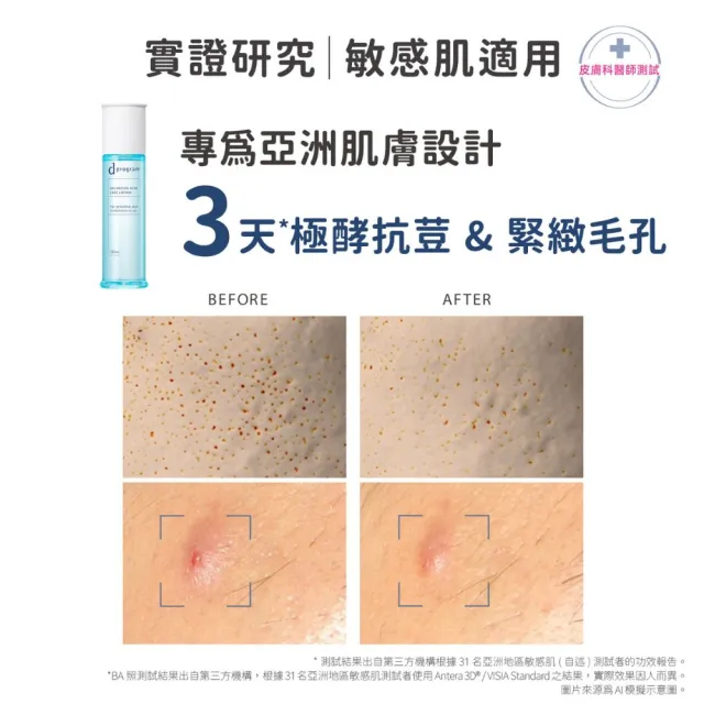 【d program 敏感話題】極效水乳均衡組 (水+乳)(淨膚/保濕 任選)(敏感肌/敏弱肌)