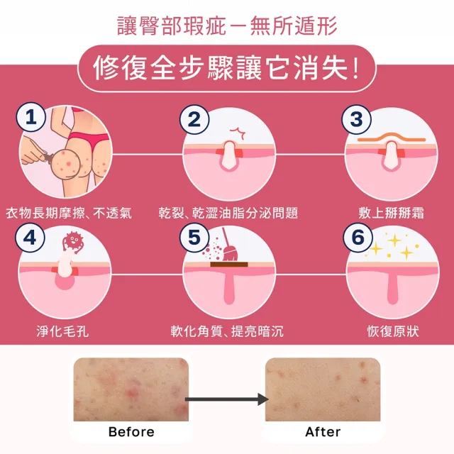 【ELLO】益生菌身體粉刺掰掰霜 Body Blemish Cream 55ML(益生菌 身體保養 乳霜)
