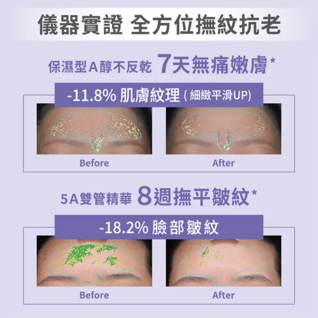 【SHIMBI METHOD 審美之選】5A醇PRO撫紋雙管精華