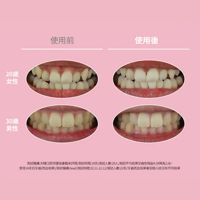【Euthymol】粉紅亮白牙膏3入澎派組