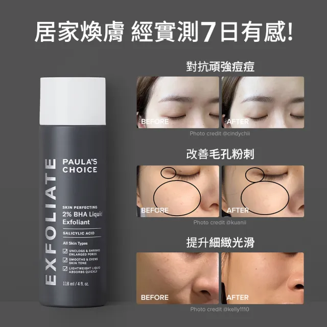 【Paulas Choice 寶拉珍選】MO獨家★2%水楊酸精華液118ml★買3送2 共5入組(抗痘/去角質/前導精華)