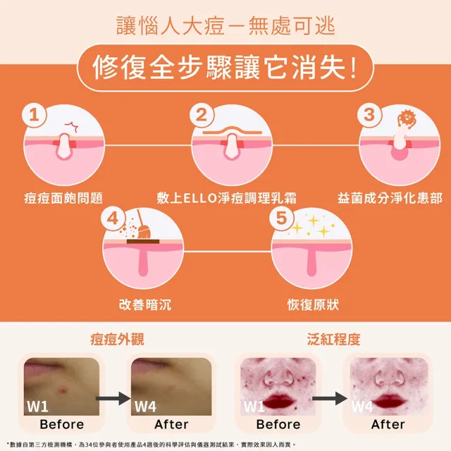 【ELLO】益生菌淨痘調理乳霜 Urgent Acne Cream 18ML 5入組