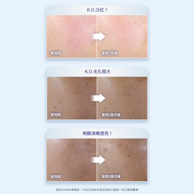 【TAKAMI】618年中慶 官方直營 小藍瓶家族組-一次享100ml(小藍瓶10ml+小藍瓶30ml+小藍瓶60ml)