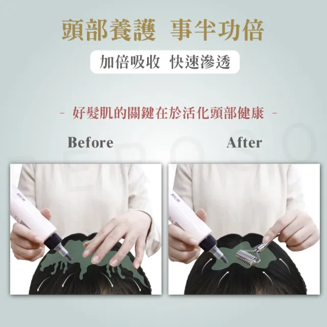 【Beroso 倍麗森】微刺頭部按摩滾輪(按摩器 按摩滾輪 頭部滾輪 美容滾輪 小臉滾輪 教師節 送禮 99購物節)