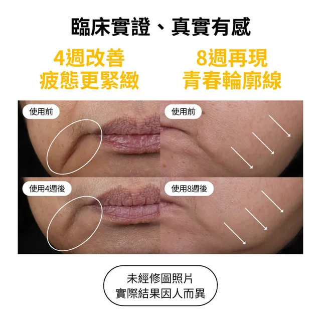 【StriVectin 皺效奇蹟】買1送4★皺效緊緻繃繃臉霜50ml(冠軍臉霜/菸鹼酸/居家拉提)
