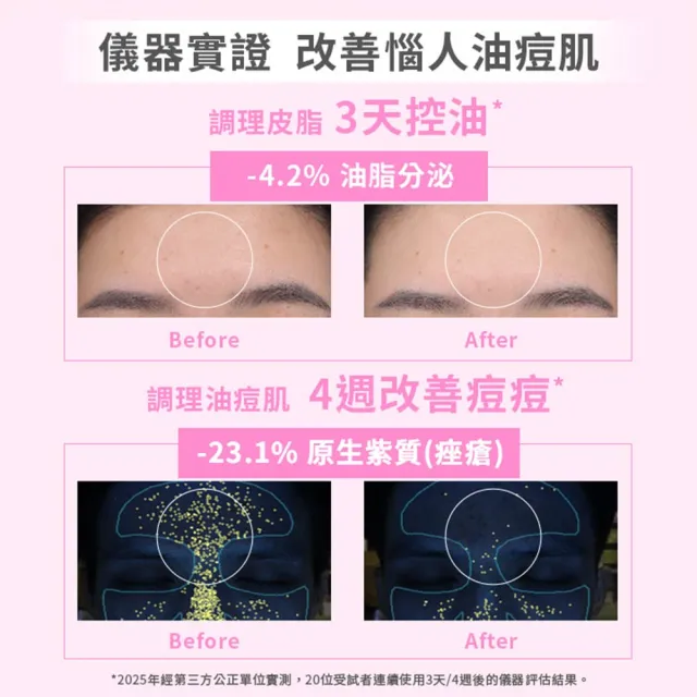 【SHIMBI METHOD 審美之選】5%杜鵑花酸控油煥膚精華2入