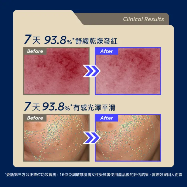 【AQUAMAX 奧科美氏】泌蘭 PDRN舒敏新生超級精華 2入分享組|新生小蘭瓶PRO、女大推薦、術後穩膚、植泌體