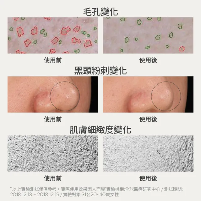 【innisfree】超級火山泥毛孔潔淨面膜 80g (毛孔吸塵器/水楊酸/控油)