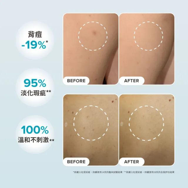 【PAULA’S CHOICE 寶拉珍選】淨無痘2％水楊酸美體噴露二入組(去角質/抗痘/美背)