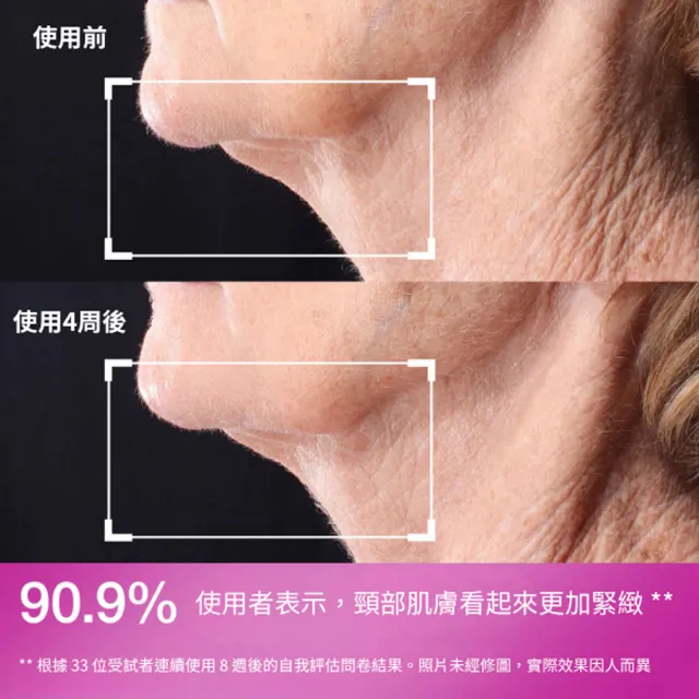 【StriVectin 皺效奇蹟】皺效緊緻胜肽繃繃頸部精萃 50ml