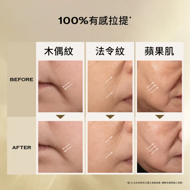 【SHISEIDO 資生堂國際櫃】激抗痕亮采緊緻超級精華 40mL