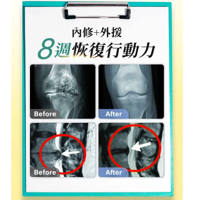 【AmaBios 亞馬生醫】MPE-311靈活粒現5盒(30粒/盒 專利雙關鍵保養配方)