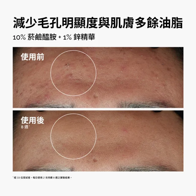【The Ordinary】控油提亮必備組 | 7%甘醇酸煥膚化妝水＆10% 菸鹼醯胺 + 1% 鋅精華