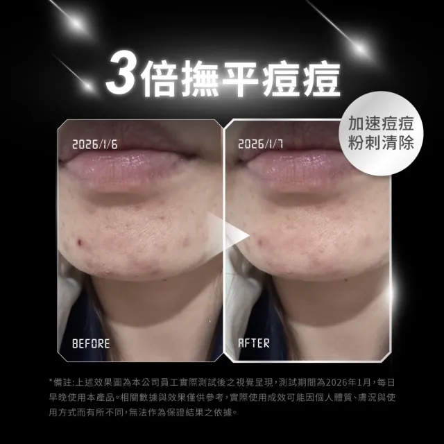 【Relove】控油零痘水凝棉片90pcs(淨化痘粉 告別油光 韓國零痘露 不留痘印 控油抗痘)