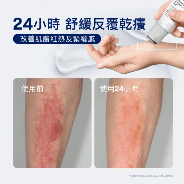 【Cetaphil 舒特膚】官方直營 AD益膚康瞬效舒敏凝膠59ml 2入組(隨身小冰塊)